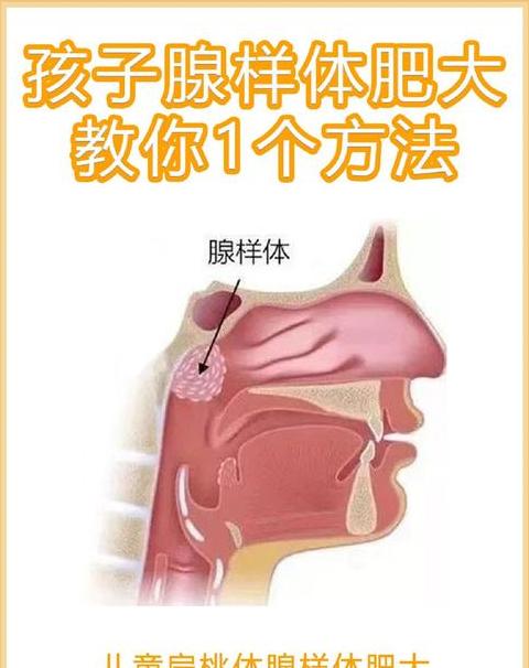 儿童腺样体肥大治疗攻略：保守与手术治疗全解析