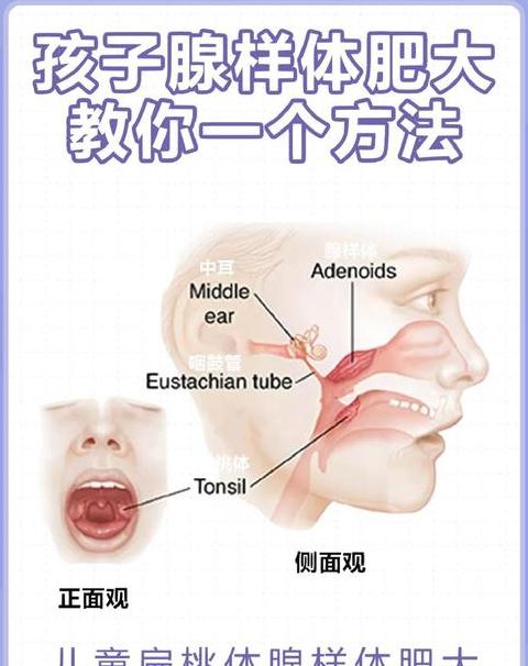 腺样体肥大自愈可能性分析