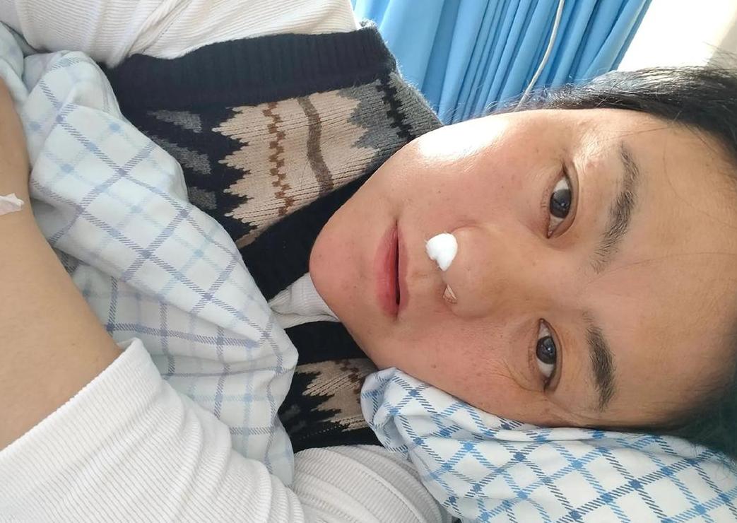 先天性后鼻孔闭锁症状解析
