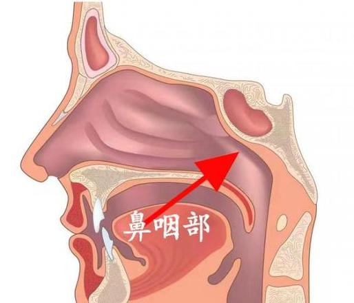 8岁儿童腺样体肥大80%后鼻孔，手术是否必要？