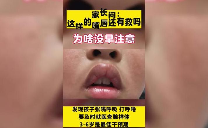 腺样体肥大自愈可能性分析
