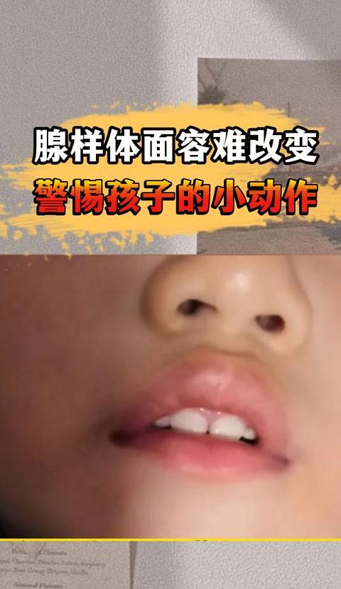 10岁儿子鼻炎自愈记：我的陪伴与太极拳修炼之旅