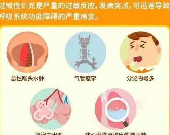 宝宝夜间咳嗽及流白鼻涕原因解析